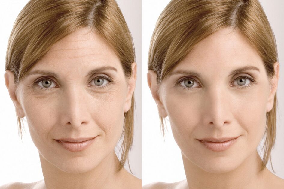 The experience of using intenskin cream before and after using it from Milan